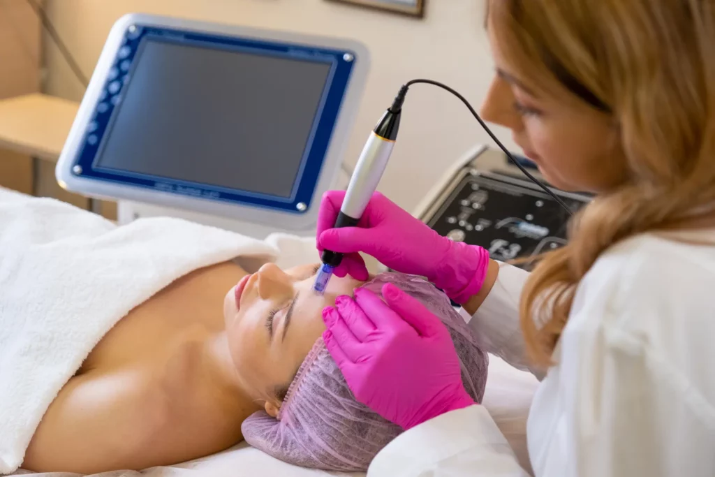 laser skin resurfacing