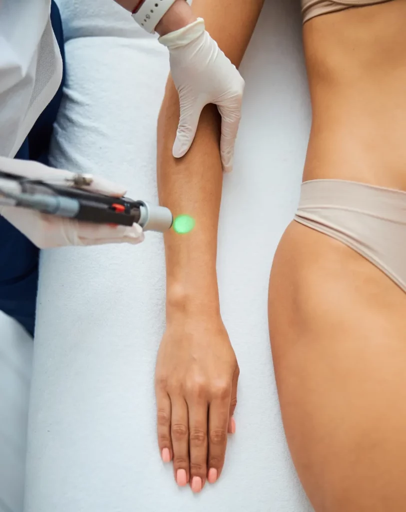 Laser Treatments in St. George